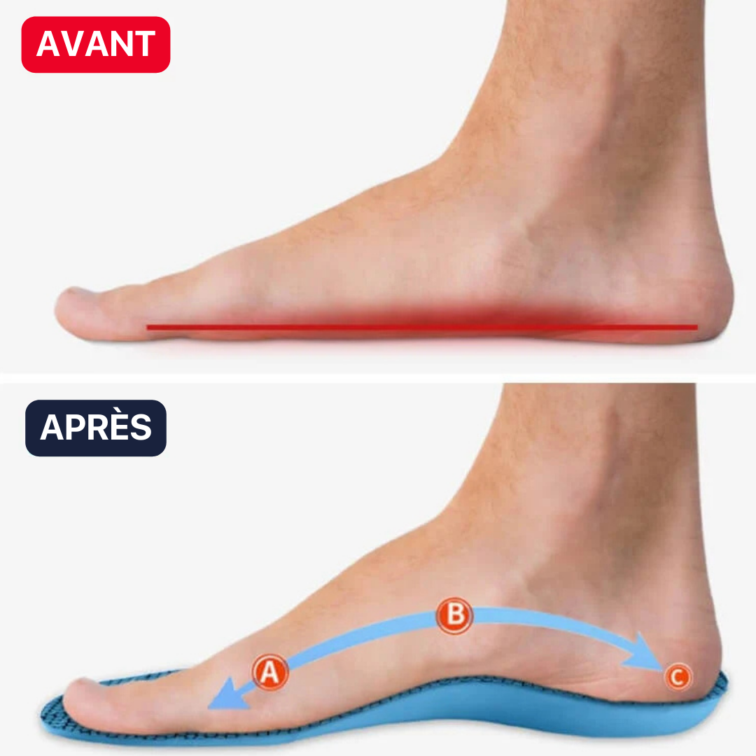 Podifix™ - Semelles Orthopediques